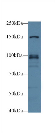 Polyclonal Antibody to Nucleoporin 98 (NUP98)