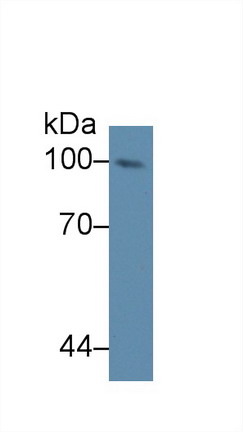 Polyclonal Antibody to Nucleoporin 98 (NUP98)