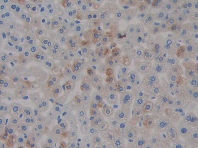 Polyclonal Antibody to Cartilage Oligomeric Matrix Protein (COMP)