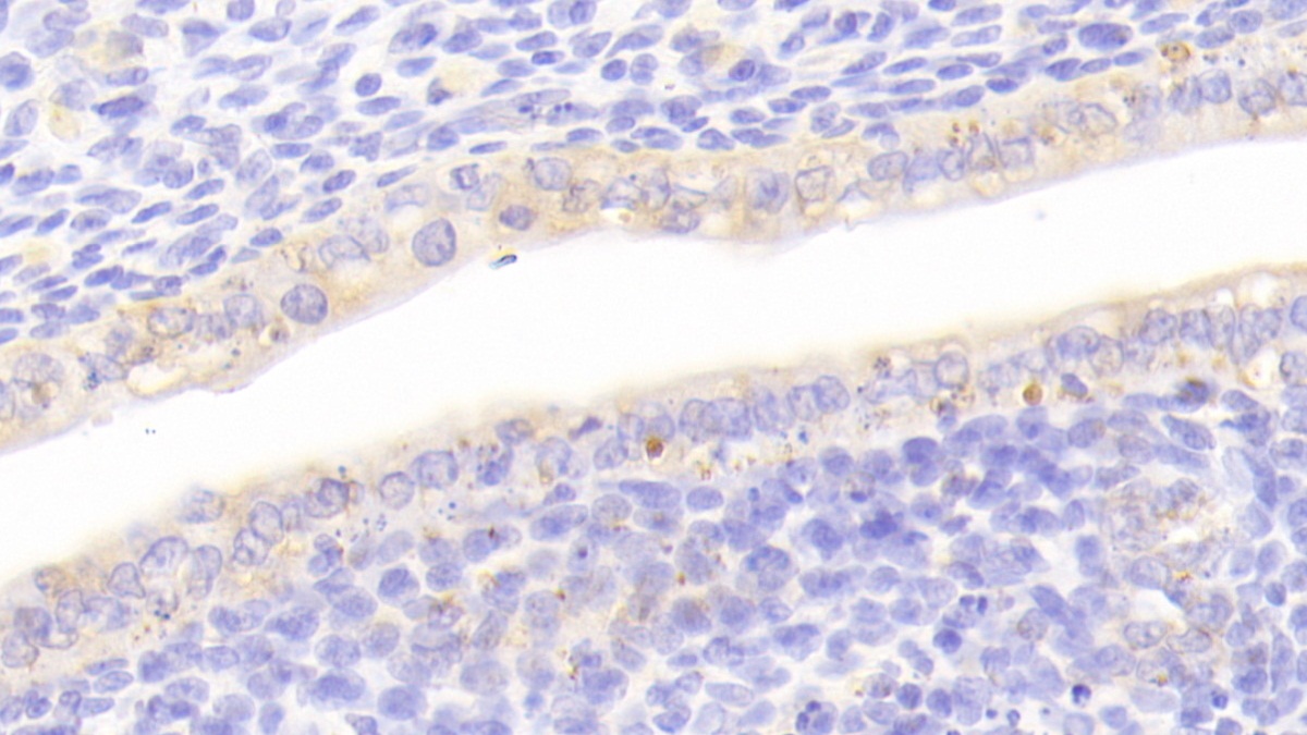 Polyclonal Antibody to Cartilage Oligomeric Matrix Protein (COMP)