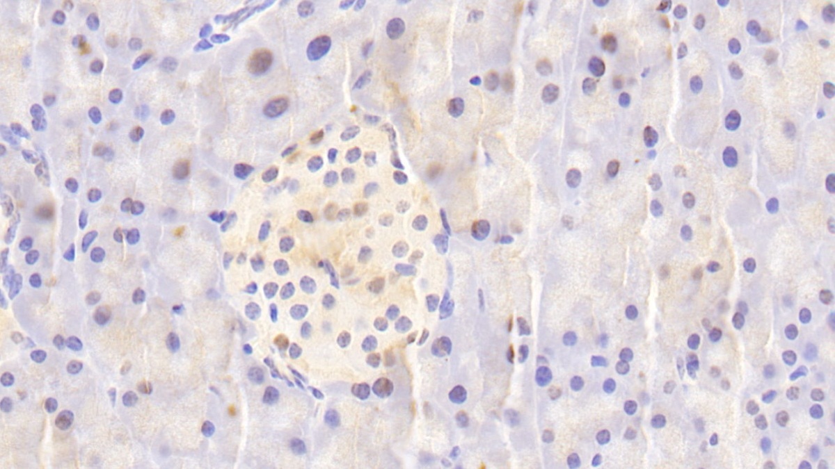 Polyclonal Antibody to Nucleoporin 88 (NUP88)