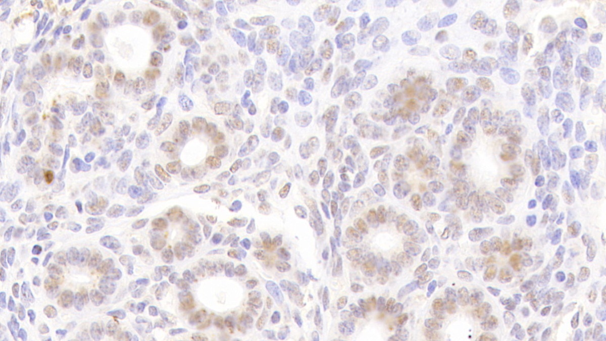 Polyclonal Antibody to Nucleoporin 88 (NUP88)