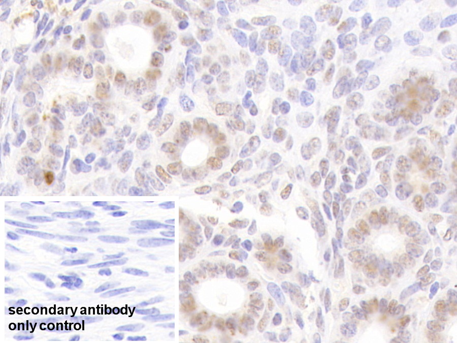 Polyclonal Antibody to Nucleoporin 88 (NUP88)