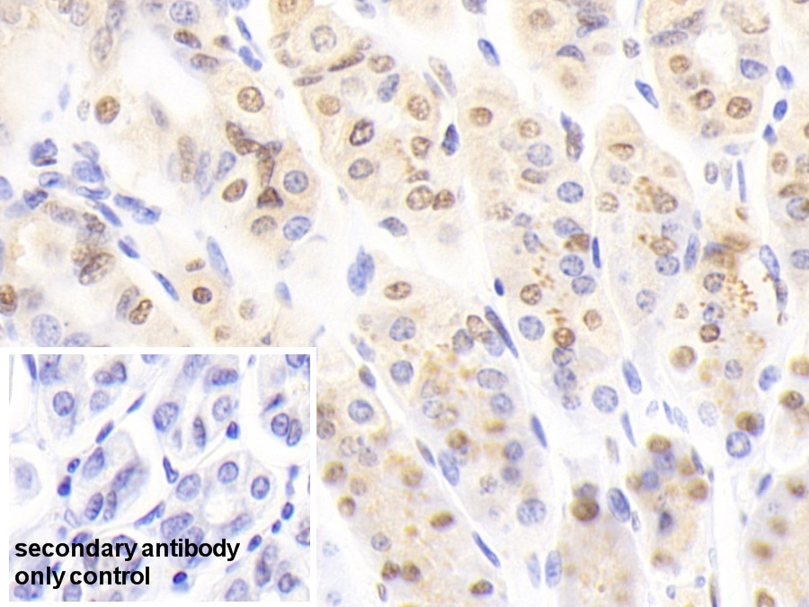 Polyclonal Antibody to Nucleoporin 88 (NUP88)