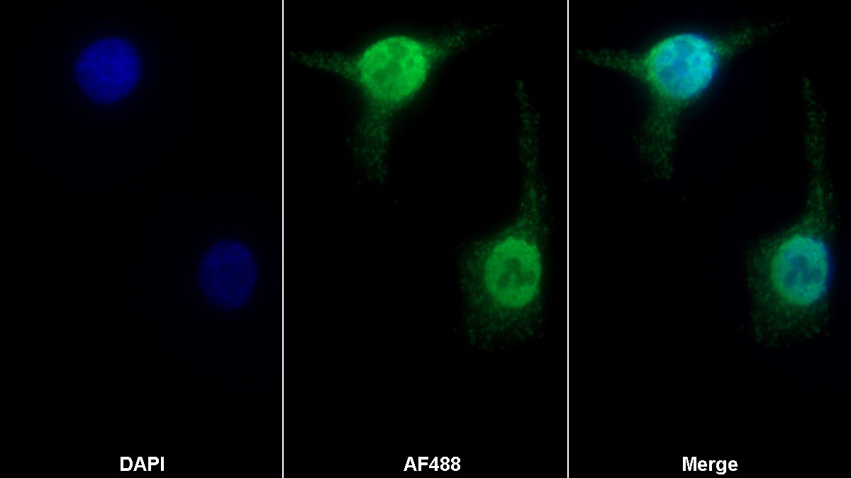 Polyclonal Antibody to Nucleoporin 88 (NUP88)