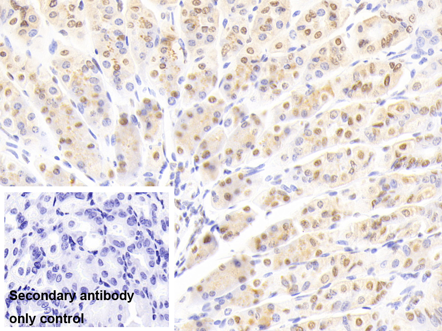 Polyclonal Antibody to Nucleoporin 88 (NUP88)