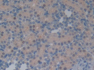 Polyclonal Antibody to Neurotensin (NT)