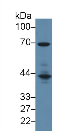 Polyclonal Antibody to Lymphocyte Cytosolic Protein 2 (LCP2)