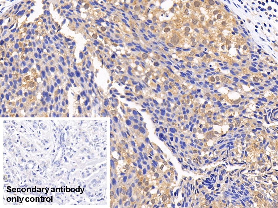 Polyclonal Antibody to Mitogen Activated Protein Kinase 14 (MAPK14)