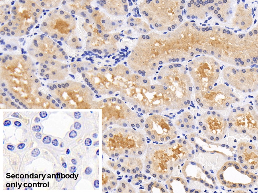 Polyclonal Antibody to Mitogen Activated Protein Kinase 14 (MAPK14)