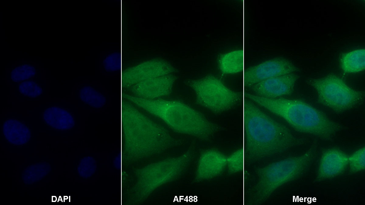 Polyclonal Antibody to Mitogen Activated Protein Kinase 14 (MAPK14)