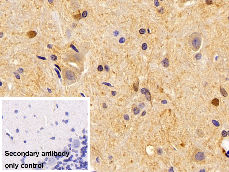 Polyclonal Antibody to Mitogen Activated Protein Kinase 14 (MAPK14)