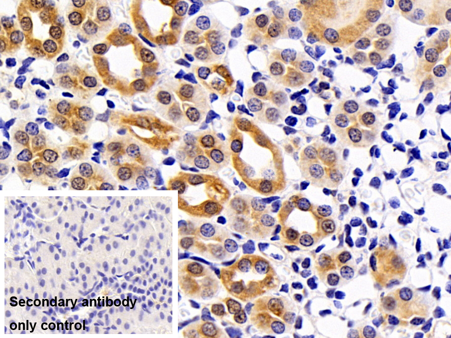 Polyclonal Antibody to Mitogen Activated Protein Kinase 14 (MAPK14)