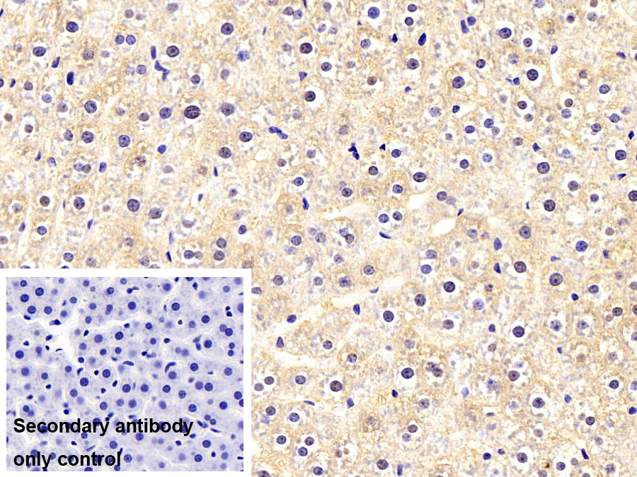 Polyclonal Antibody to Mitogen Activated Protein Kinase 14 (MAPK14)