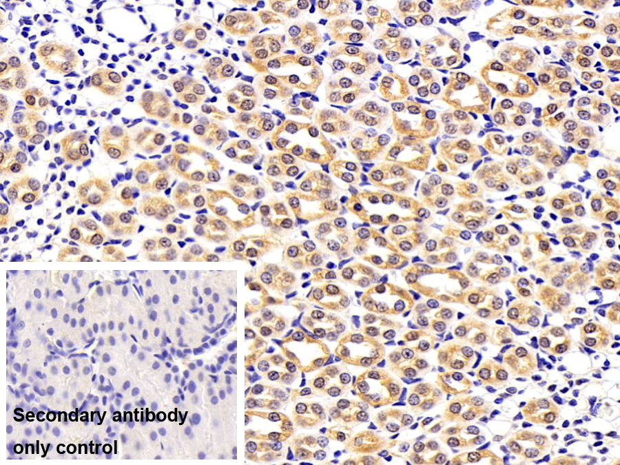 Polyclonal Antibody to Mitogen Activated Protein Kinase 14 (MAPK14)