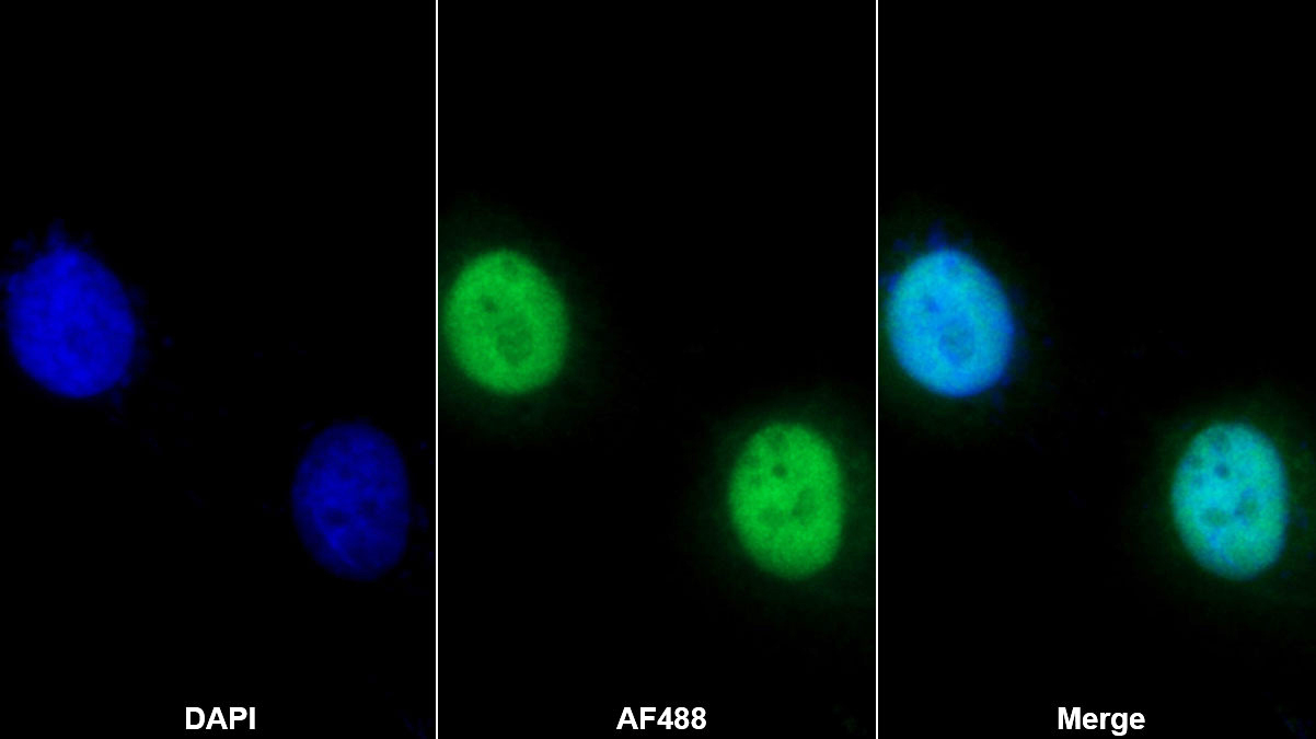 Polyclonal Antibody to Retinoblastoma Protein 1 (RB1)