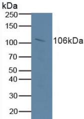 Polyclonal Antibody to Retinoblastoma Protein 1 (RB1)