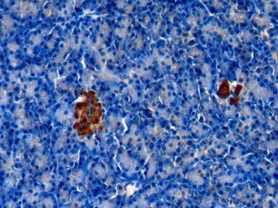 Polyclonal Antibody to Chromogranin A (CHGA)