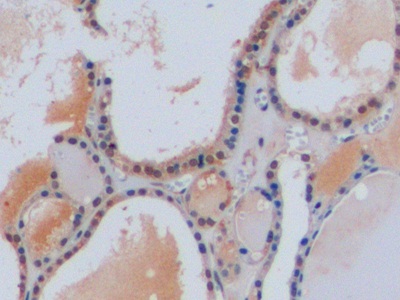 Polyclonal Antibody to Chromogranin A (CHGA)