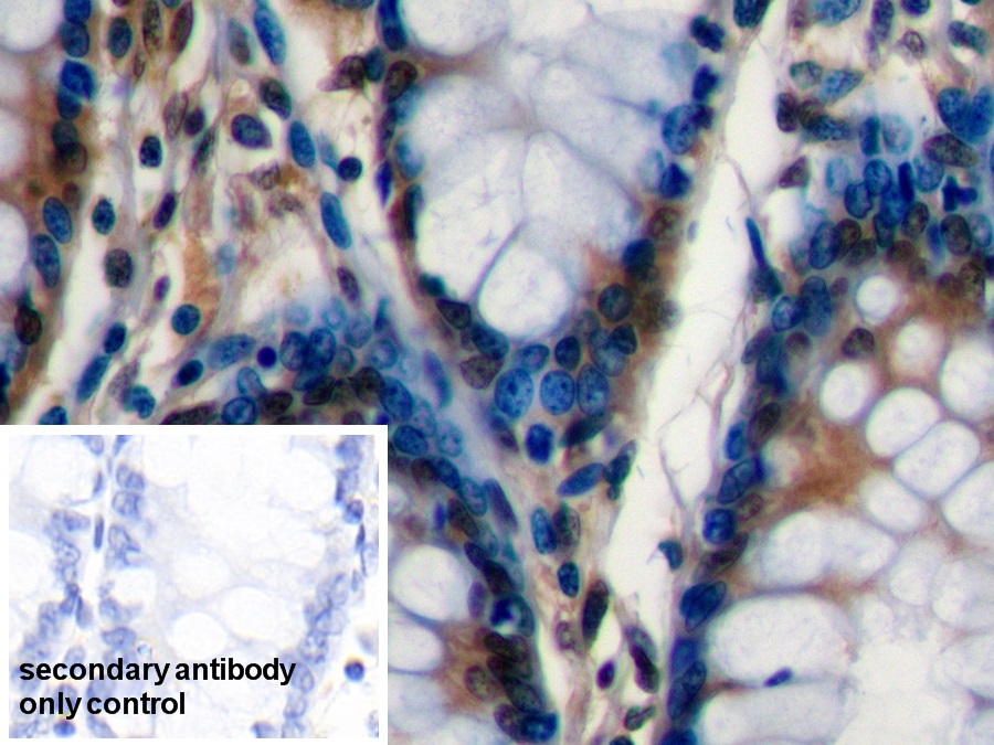 Polyclonal Antibody to Chromogranin A (CHGA)