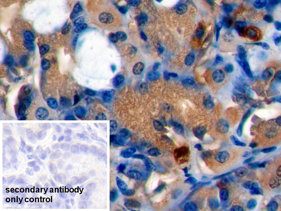 Polyclonal Antibody to Chromogranin A (CHGA)