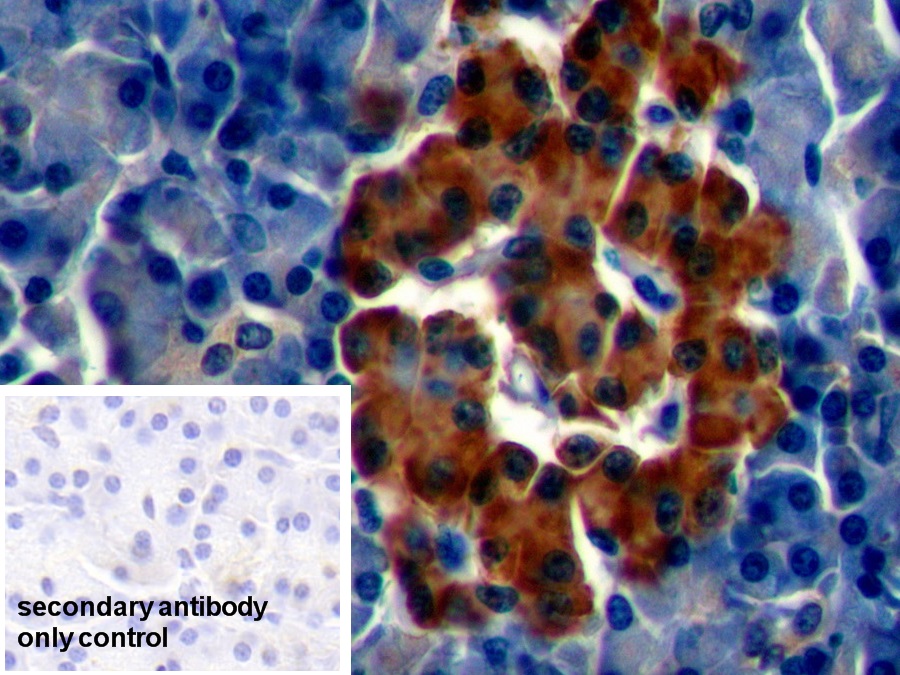 Polyclonal Antibody to Chromogranin A (CHGA)