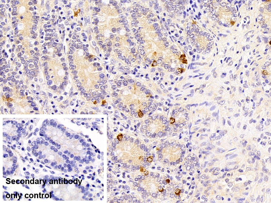 Polyclonal Antibody to Chromogranin A (CHGA)