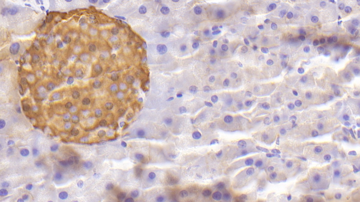 Polyclonal Antibody to Chromogranin A (CHGA)