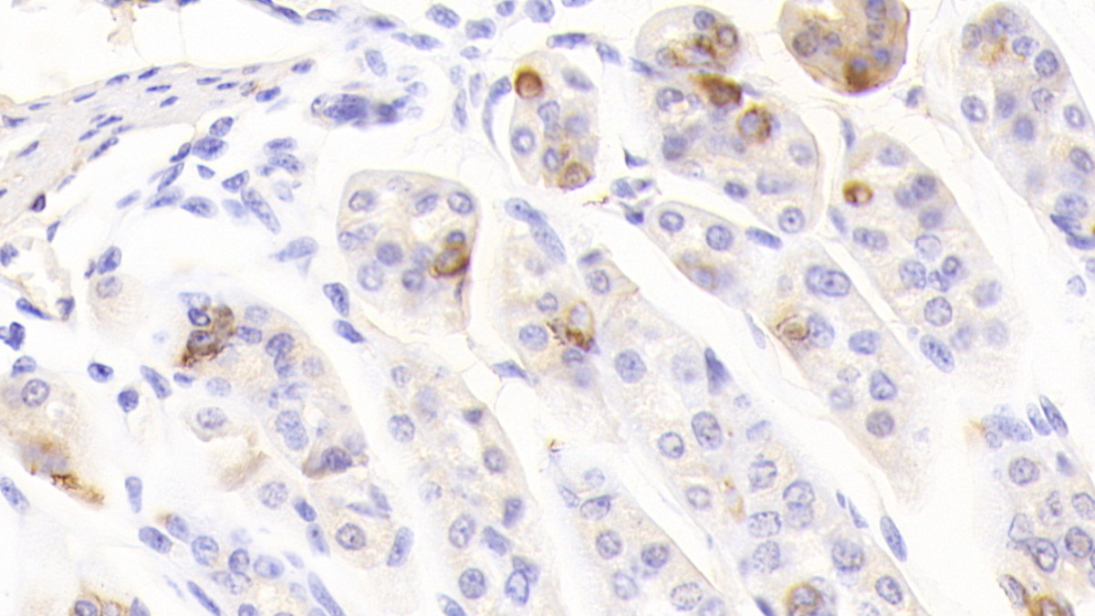 Polyclonal Antibody to Chromogranin A (CHGA)