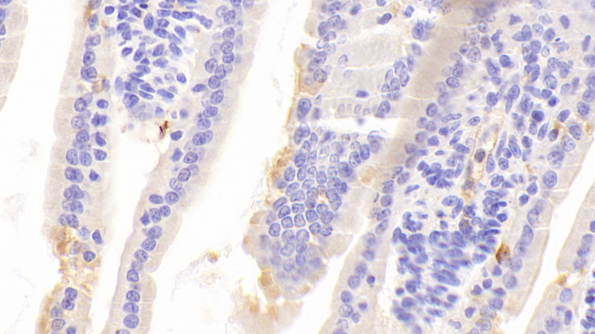 Polyclonal Antibody to Chromogranin A (CHGA)