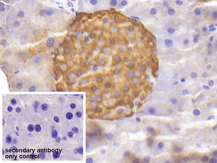 Polyclonal Antibody to Chromogranin A (CHGA)