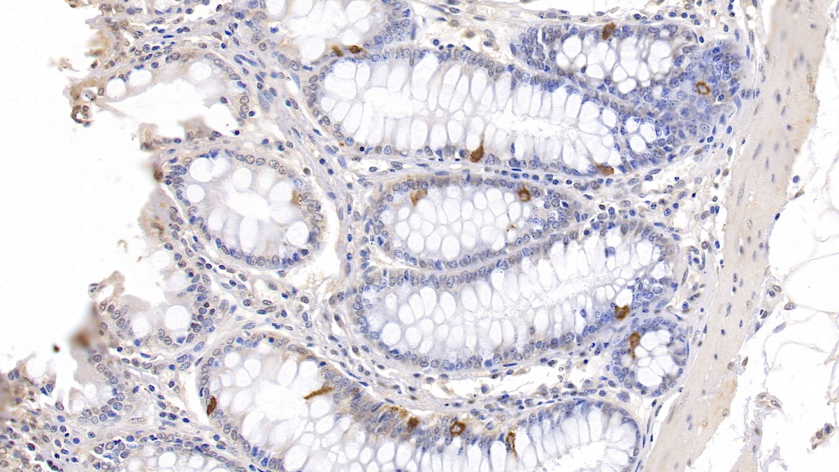 Polyclonal Antibody to Chromogranin A (CHGA)