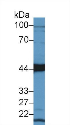 Polyclonal Antibody to Aspartate Aminotransferase (AST)