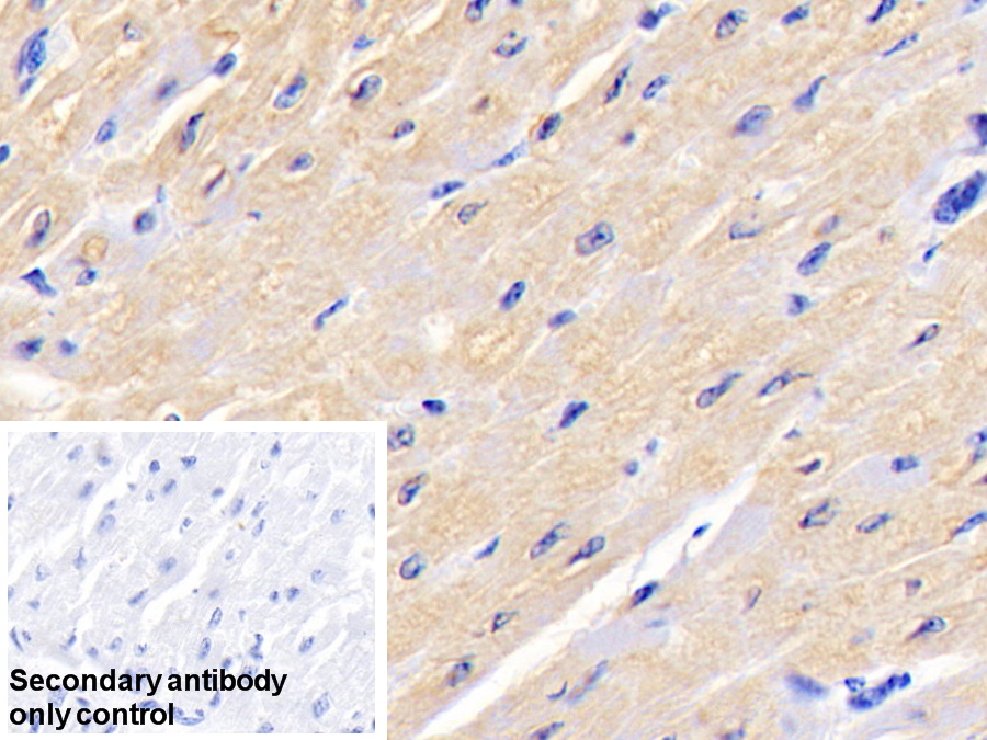 Polyclonal Antibody to Aspartate Aminotransferase (AST)