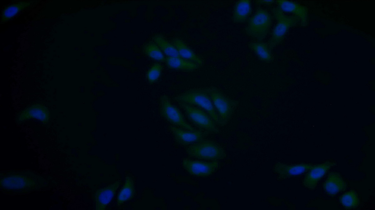 Polyclonal Antibody to Aspartate Aminotransferase (AST)