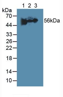 Polyclonal Antibody to Fibrinogen Beta Chain (FGB)