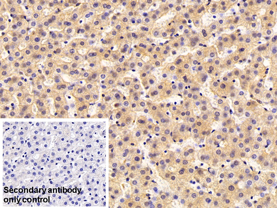 Polyclonal Antibody to Fibrinogen Beta Chain (FGB)