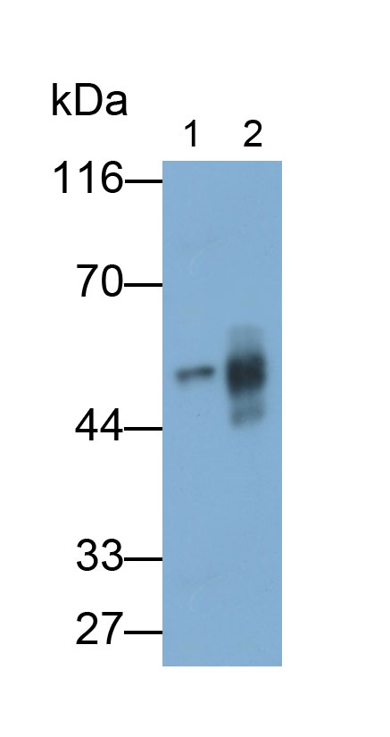 Polyclonal Antibody to Fibrinogen Beta Chain (FGB)