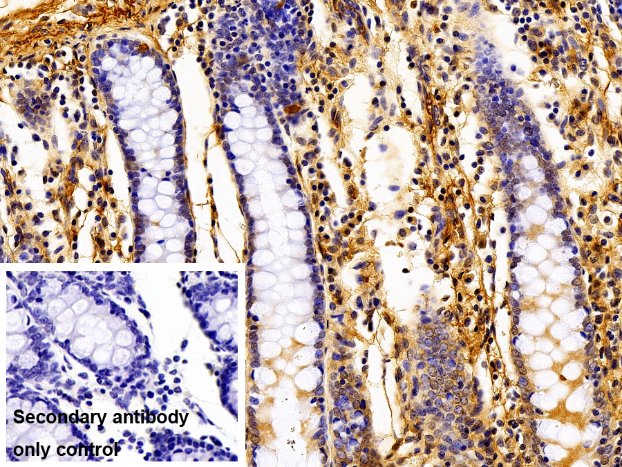 Polyclonal Antibody to Fibrinogen Beta Chain (FGB)