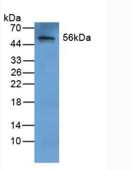 Polyclonal Antibody to Fibrinogen Beta Chain (FGB)