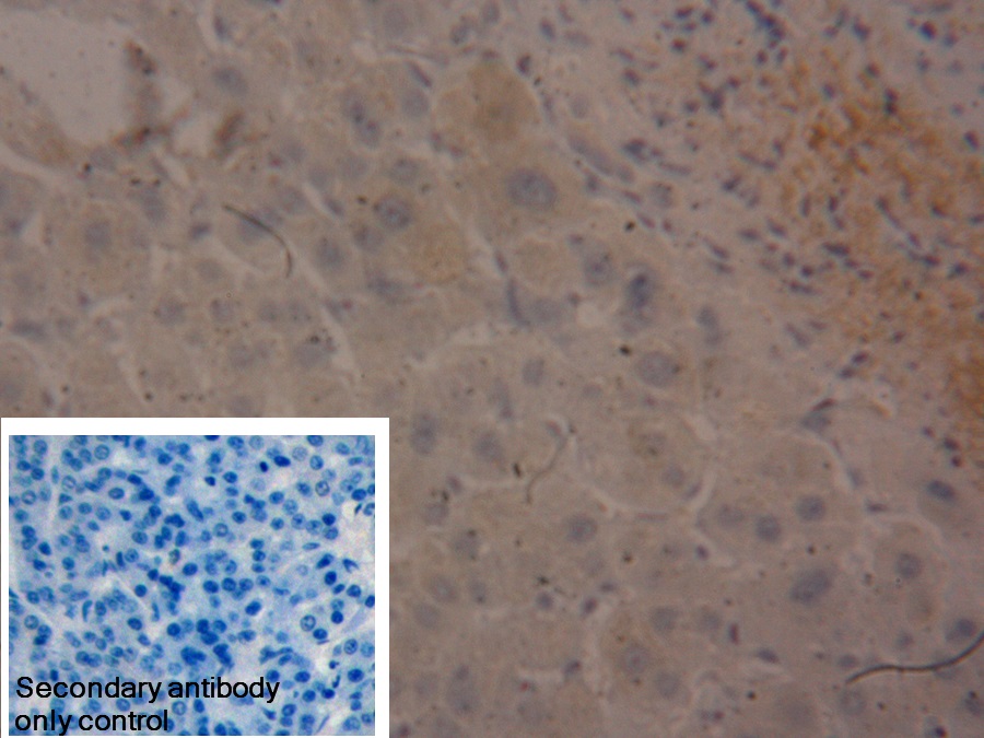 Polyclonal Antibody to Fibrinogen Beta Chain (FGB)