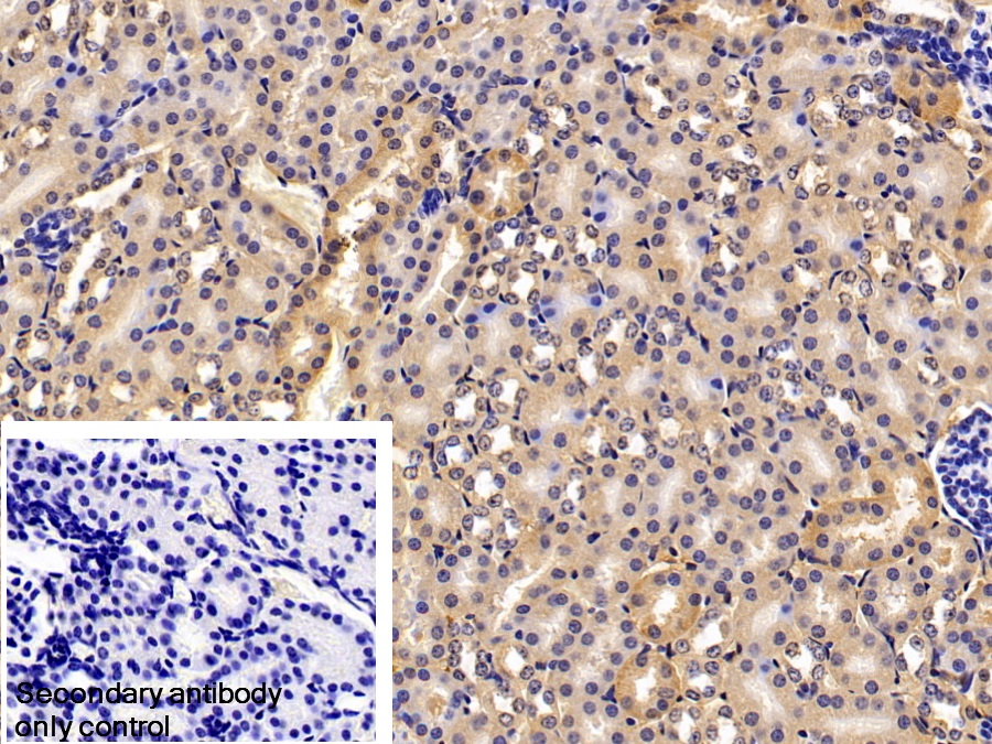 Polyclonal Antibody to Fibrinogen Beta Chain (FGB)