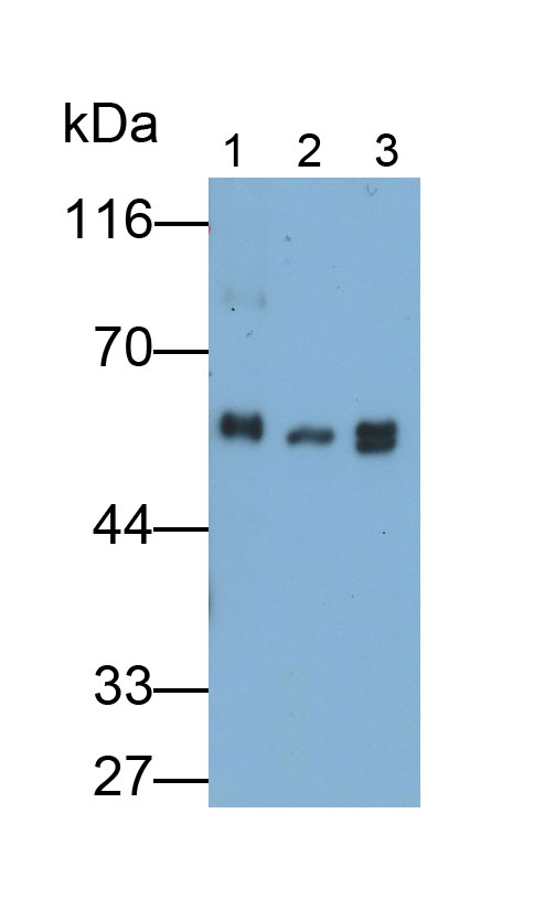 Polyclonal Antibody to Fibrinogen Beta Chain (FGB)