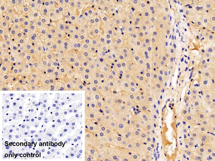 Polyclonal Antibody to Fibrinogen Beta Chain (FGB)