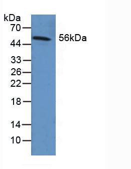 Polyclonal Antibody to Fibrinogen Beta Chain (FGB)