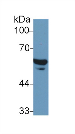 Polyclonal Antibody to Fibrinogen Beta Chain (FGB)