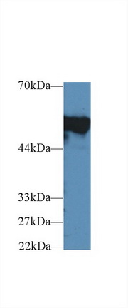 Polyclonal Antibody to Fibrinogen Beta Chain (FGB)