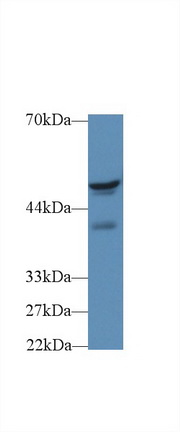 Polyclonal Antibody to Fibrinogen Beta Chain (FGB)