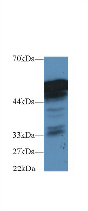 Polyclonal Antibody to Fibrinogen Beta Chain (FGB)