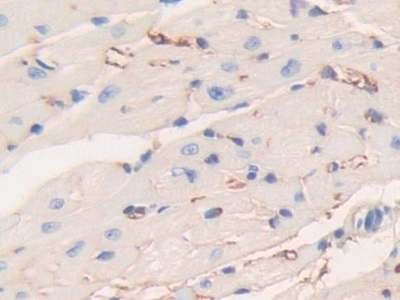 Polyclonal Antibody to Fibrinogen Beta Chain (FGB)